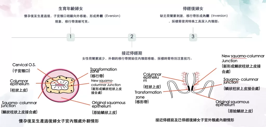 不同生理階段的子宮頸變化