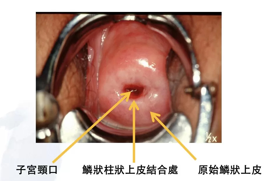 子宮頸基本構造